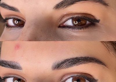 before and after of microblading eyebrows