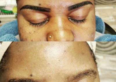 image of before and after of microblading